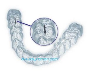 Falsos Invisalign original