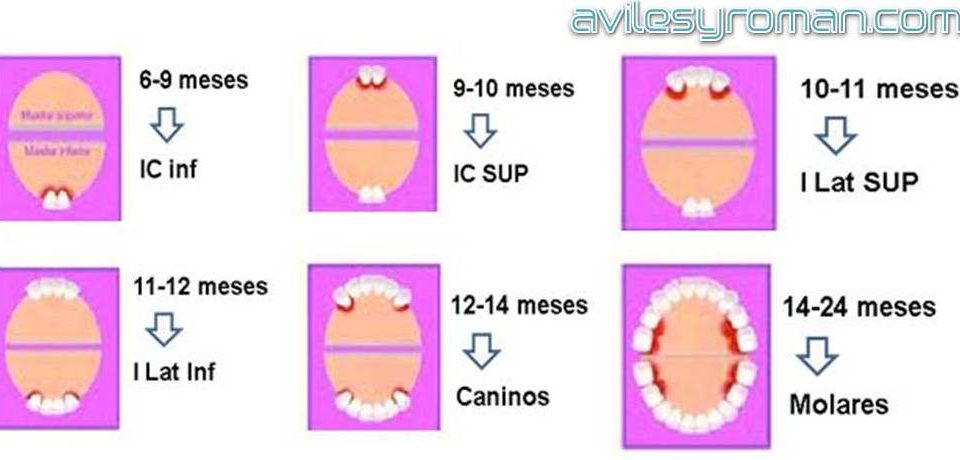 Erupcion Dientes Aviles y Roman