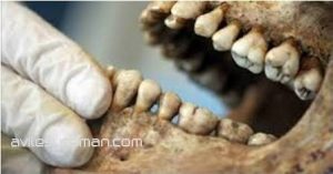 Odontologia forense