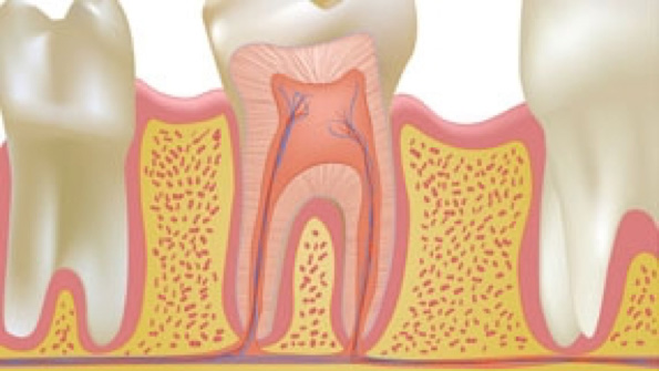 endodoncia