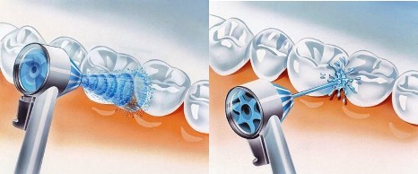 irrigador-dental