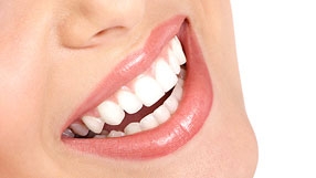 Estetica Dental Malaga